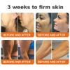AEEHFENG Lotmay Bee Venom Restorative Cream, Advanced Skin Firming Body Lotion, Lotmay Bee Venom Cream, Reduces wrinkles and blemishes, Natural Ingredients Suitable for All Skin Types (4 Bottle) view 2