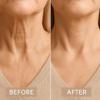 Invisible Neck Lift Tape Neck Instant Lifting Firming Tape Improves Neck Lines Wrinkles High Elastic Breathable Lifting Invisible Reusable Waterproof Use Before Makeup (8 strips+40 patches) view 3