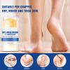 Holyarm 3PCS 60% Urea Hydrating and Anti-Cracking Foot Cream, Maximum Strength Urea Cream for Feet, Foot Lotion Stick for Heels, Dry Hands & Rough Knees, Smoothing Skin Women and Men view 4