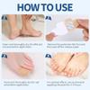TEAWOO 50PCS Toenail Nail Patches, Self-Adhesive Conditioning Stickers view 4
