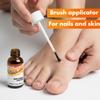 HONGOCURA Antifungal Nail Brush for Athletes Foot, Toenails & Fingernails | Precision Applicator for Nail Fungus & Ringworm Relief | Fast-Drying, Non-Greasy Liquid Formula | 10 mL | 2-Pack view 4