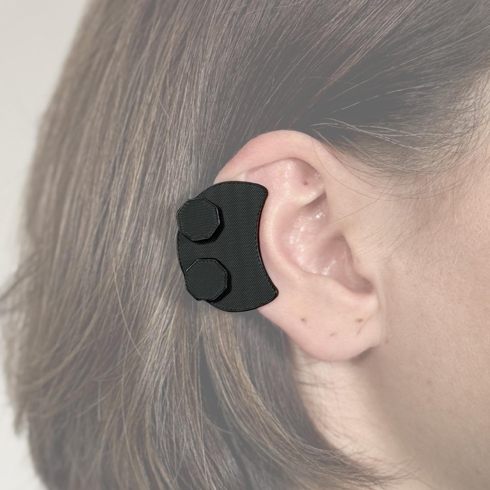 Keloid Compression Earring  Clinically Designed Medical Pressure Helix Earlobe for Ear Keloid Removal, Post-Surgery Healing & Scar Treatment