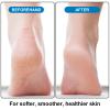 Foot Pumice Stone 2 Pack Pedicure Stone for Feet Pumice Sponge for Feet Callus Remover and Scrubber Double Sided Pedicure Foot Pumice Stone for Feet and Heels Callus and Dead Skins (Purple) view 4