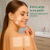 Waspot Original Hydrocolloid Acne Patches (17 Count) | Medical Grade for Cystic Breakouts, Invisible Spot Treatment & Overnight Healing view 2