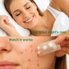 Waspot Original Hydrocolloid Acne Patches (17 Count) | Medical Grade for Cystic Breakouts, Invisible Spot Treatment & Overnight Healing view 3