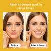 Waspot Pore Minimizing Gel | Daily Blackhead Dissolving Gel with Jojoba Beads, Non-Comedogenic, for Oily/Acne-Prone Skin view 4