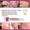 Azelaic Acid for Face Balance Skin Tone & Cleanse Pores, Azelaic Acid Serum Acido Azelaico-Relieve Acne, Blackhead & Redness,Premium Skin Care, 20g (1 PCS) view 3