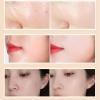 Soft Matte Cream Concealer, Soft Matte Full Coverage Cream, Face Hydrating Concealer Creams, Color Correcting Coverage Creams (Medium) view 4