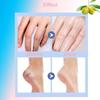 Wegodal Moisturizing and Anti-Cracking Ointment Stick, 2025 Upgraded 60% Urea Hydrating and Anti-Cracking Foot Cream, Foot Cream for Dry Cracked Heels and Feet Women Men (Blue, One Size) view 2