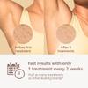 Philips Lumea 7000 Series IPL Hair Removal Device, for Women & Men, Visible Permanent Laser Hair Reduction Done at Home, SenseIQ Technology, Uniquely Curved Attachment for Body, BRI931/03 view 4