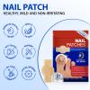 Nail Repair Patches, Nail Treatment Patches Extra Strength, Toenail Treatment 8 Hour Overnight Nail Fast Acting Repair Easy to Apply 42 PCS view 4