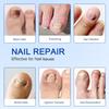 Toenail Treatment Extra Strength, Nail Repair Patches, Overnight Nail Fast Acting Repair, Improves Texture, Restore Discoloration and Thickness, Easy To Use 21 PCS view 2
