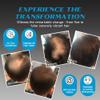 Mr.Bold Hair Building Fibers 27.5g (Gray) Hair Fibers for Thinning Hair for Men & Women  Conceals Fine Hair, Bald Spots, Hair Loss  Instantly Fuller Thicker Hair Look  Hair Concealer Powder view 4
