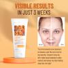 ABERA Turmeric Face Wash for Acne-Prone & Sensitive Skin  4-in-1 Curcumin Cleanser with Niacinamide, BHA & Centella  Gentle pH Balanced, Non-Comedogenic, Sulfate Free Facial Cleanser, 3.38 Fl.oz. view 3