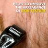 The Beard Club Derma Roller for Face, Body and Scalp - Microneedling for Men and Women with 540 Titanium Microneedles - Beard Roller & Micro Needling Scalp Hair - Gray & Black view 4