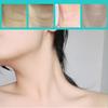 24 pcsNeck Firming Patch - Neckband Lift Invisible Patch, instantly eliminates double chin effect, seamless skin tightening effect, shapes smooth neck contour (V28-Skin color) view 4