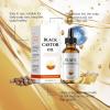Black Castor Oil for Hair Growth, Cold Pressed, Hexane Free with Vitamin E, 2 FL OZ, Hair Loss Treatment view 4