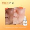 10% Niacinamide Serum,with 1% Zinc PCA, 0.5% Bakuchiol, Moringa & Tulsi Extract| Brightening for Glowing Skin, Acne Marks, Dark Spots, Pigmentation & Oily Skin 30ml view 4