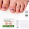 Nail Correction Patch | 10 Piece Correction Patches for Toe Nails | Corrector Strips Stickers for Repair Care Women Men Adult Foot Home view 3
