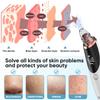 Blackhead Remover Pore Vacuum  3 Suction Levels & 5 Probes  Facial Cleaner for Nose & Face  Rechargeable Comedone Extractor with LED Display view 2