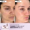 SEYOUL Meso White Facial Serum Ampoules  Uneven Tone Appearance & Skin Radiance Support with Niacinamide, Stem Cells & Collagen  6 Vials (0.17 fl oz Each) view 4