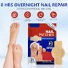 Nail Patches, 8-Hour Overnight Treatment, Fast-Acting Toenail Repair Patches, 21 Patch,for Damaged Nails Foot Nails Repair and Care,Strengthens Brittle Nail view 4