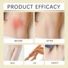 3 Pcs Cyperus Rotundus Oil, Reducing Body Hair Growt Premium Natural Cyperus Rotundus Oil for Hair Removal and Nourish SkinCare. view 3