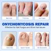 Nail Patches, 42P Nail Patches for Toenails, Nail Treatment Patches Extra Strength, Extra Strong 8-Hour Repair Nail Plasters, Overnight Toe Nail Care Repair for Damaged Nails view 3