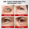 Retinol & Caffeine Eye Serum -360 Massage Roller for Puffiness,Eyebag Remover,Wrinkle Filler,Under Eye Cream For Dark Circles 0.54fl.oz (Pack of 1) view 2