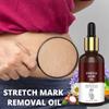RG Stretch Mark Removal Oil for Women 30 ml (Pack of 1) view 2