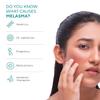 100% Natural Melasma Cream 100g, Pigmentation Removal Cream for Even Skin Tone, Dark Spot Removal Crea'm Enriched with Rice Barn, Kakadu Plum, Marshmellow & Licorice roots view 4