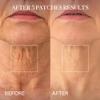 depology Tightening and Lifting Neck Wrinkle Patches with Cream, PDRN Deep Collagen Neck Mask, Firming Patch with PDRNCollagen and Niacinamide Cream view 2