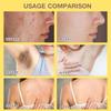Bee Venom Skin Treatment Cream,2025 New Professional Natural Repair Gel,Effectively reduces all types of skin blemishes (2) view 2
