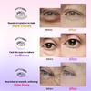 AILEORY Under Eye Patches for Dark Circles, Puffiness, Fine Lines, Eye Mask Set with Retinol, 24K Gold, Caffeine, Gel Mask for Birthday & Spa Party Favors, Skincare Gift for Women & Men, 24 Pairs view 4