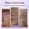 BEAUTNICE Exfoliating Gel AHA BHA with Glycolic, Salicylic & Lactic Acid for Pores, Blackheads, Acne, Sensitive Skin, Gentle Face & Body Peel Gel Centella, 2.03 fl oz view 3