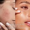 AbsolutSkin Brightening Face Wash  Gentle Daily Cleanser with Kojic Acid, Vitamin C & Alpha Arbutin  Fades Dark Spots & Evens Skin Tone  120ml view 4