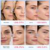 Avorla LED Light Therapy Mask, LED light therapy for face to reduce wrinkle and acne, Red, Blue & Near Infrared Facial Skincare Device view 4