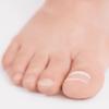 Light-Curing Nail Correction Gel  LED-Activated, Mouldable Formula for Passive Bracing or Nail Reconstruction  Natural Shade, Easy-Use Applicator view 4