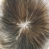 Hair Wonders Fine Mono Mens Toupee Hair Replacement System For Men Lace Front Hairpiece for Men Hair System Mens Hairpieces (#18 Medium Blonde, 8x10-120% Light Medium Density) view 4
