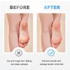 9PCS Foot Pumice Stone, 2025 Upgraded Professional Pedicure Foot Pumice Stone for Feet Hard Skin Callus Remover and Scrubber, Durable Exfoliating Stone for Spa Pedicure (Colorful-A) view 4