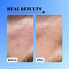 10% Glycolic Exfoliating Treatment Tonic (1oz) view 4