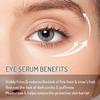 Eye Serum for Dark Circles & Anti-Aging - With Black Rice Extract & Bakuchiol for Wrinkles, Deep Moisturizing & Firming, Under Eye Cream for Puffiness with 360 Roller Massage, 15ml/0.5fl.oz(2pack) view 2