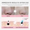 Blackhead Remover Vacuum, Pore Cleaner Blackhead Extractor, Pore Vacuum with 3 Adjustable Suction Levels & 4 Probes, USB Rechargeable Blackhead Remover Tools for Face & Nose (Pink) view 3