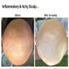 Dr Stone's Laboratory Scalp Conditioner - Tea Extract Relieves Itchiness, Removes Dandruff, Stops Hair Fall, Regrow Hair view 3