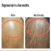 Dr Stone's Laboratory Scalp Conditioner - Tea Extract Relieves Itchiness, Removes Dandruff, Stops Hair Fall, Regrow Hair view 4