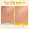 TOSOWOONG Real Kojic Acid Turmeric Fit, Peel-Off Mask for Even Tone, Glow view 2