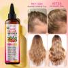 35-in-1 Blend Rosemary Hair Oil with Batana, Argan, Jojoba, Castor Oil, Infused with Keratin, Biotin & Vitamin A C D E, Super Hair & Scalp Oil for Strengthening & Nourishing Hair, All Hair Types view 4