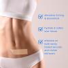 Pack of 8,Silicone Sheets For Scars, Scar Tape For Surgical Scars,Scar Removal Treatment Healing Patches,Reusable Silicone Scar Strips for C-Section, Keloid, Burn, Acne, Surgical Scar view 3