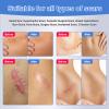 Pack of 8,Silicone Sheets For Scars, Scar Tape For Surgical Scars,Scar Removal Treatment Healing Patches,Reusable Silicone Scar Strips for C-Section, Keloid, Burn, Acne, Surgical Scar view 4