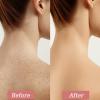 Strawberry Skin Treatment, Trystrawberry Legs Resurfacing Cream, Advanced Triple-Acid Complex For Keratosis Pilaris, Reduce Chicken Skin Bumps (1) view 2